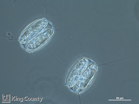 Photo of Thalassiosira punctigera